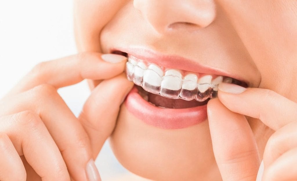 affordable Invisalign in Bayside New York