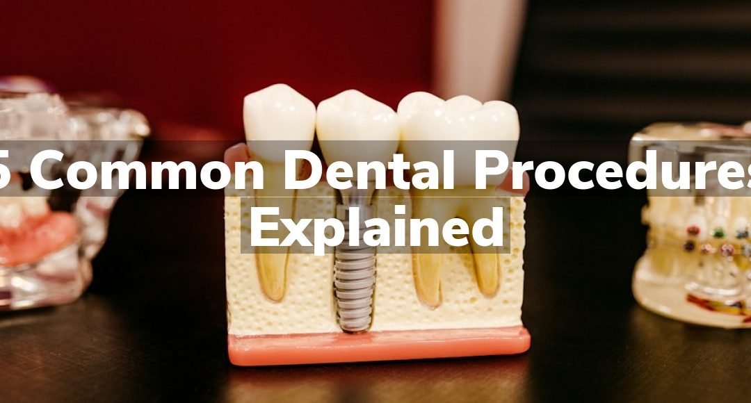 5 Common Dental Procedures Explained