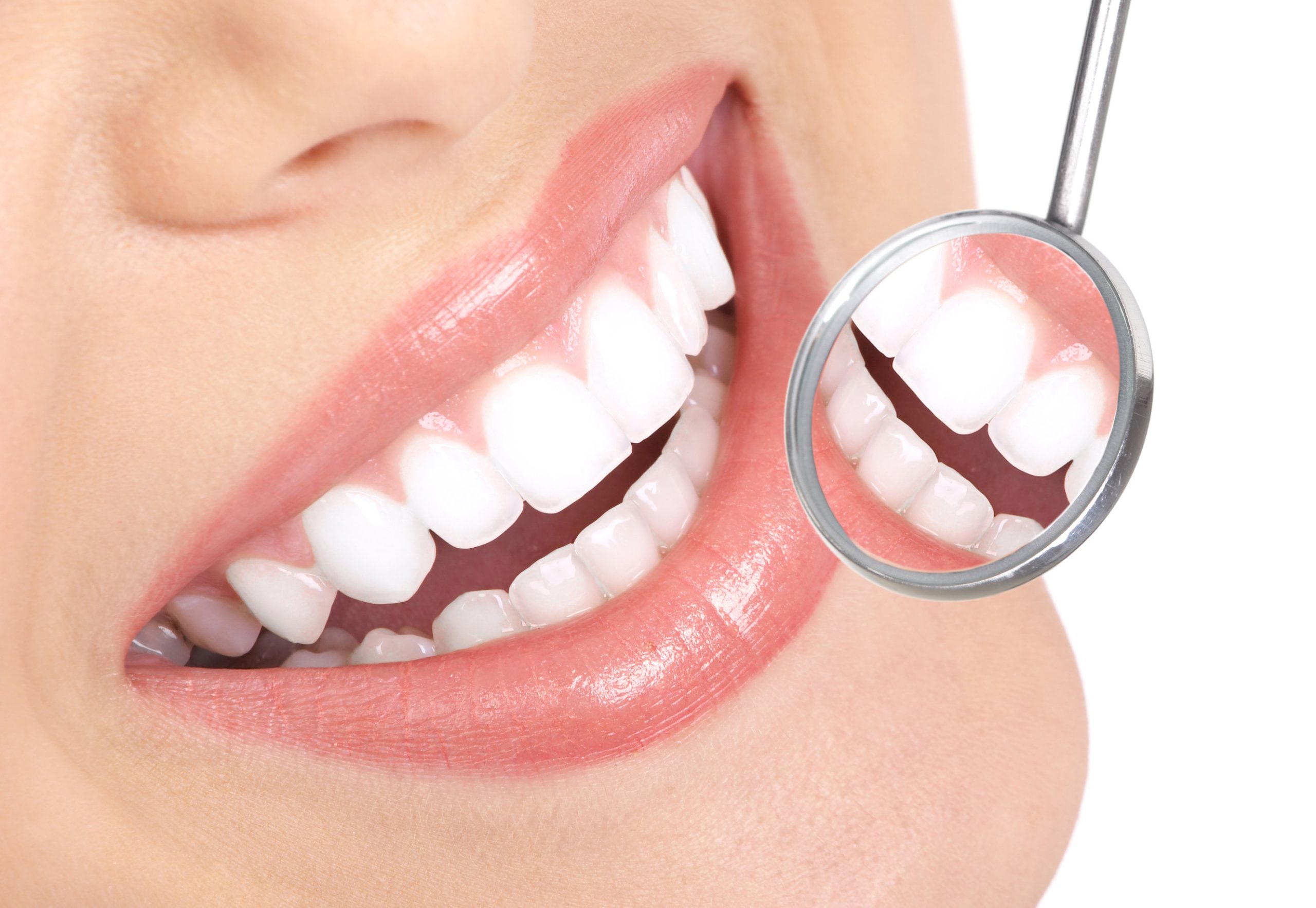 Teeth Whitening – Corbin Dental Teeth whitening in Bayside, NY with Corbin Dental.