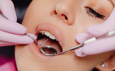 The Dental Implant Process