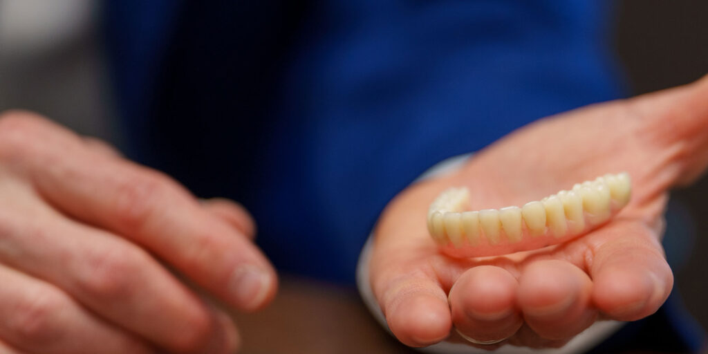 Doctor Holding a Full arch of dental implant model