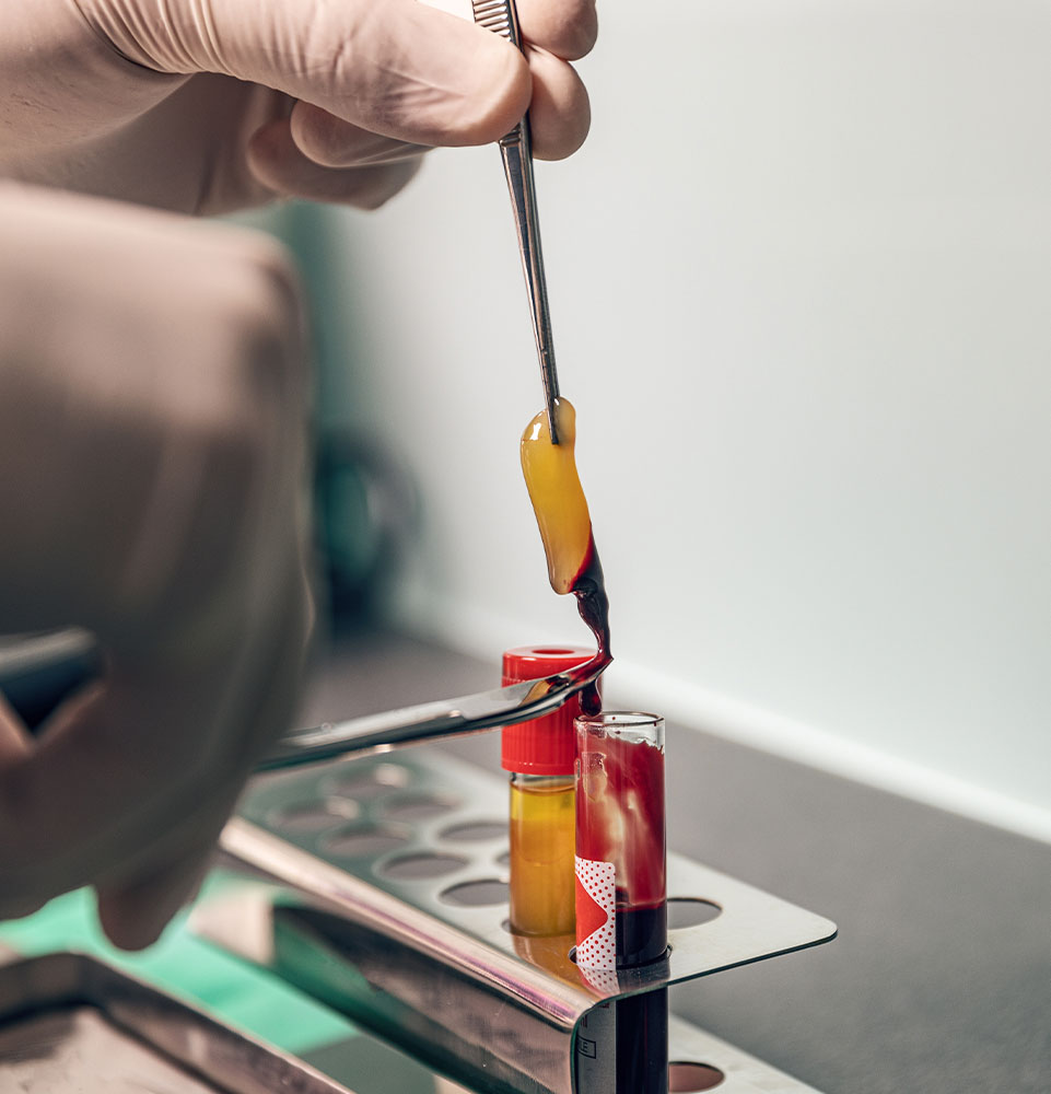 Platelet-Rich Fibrin