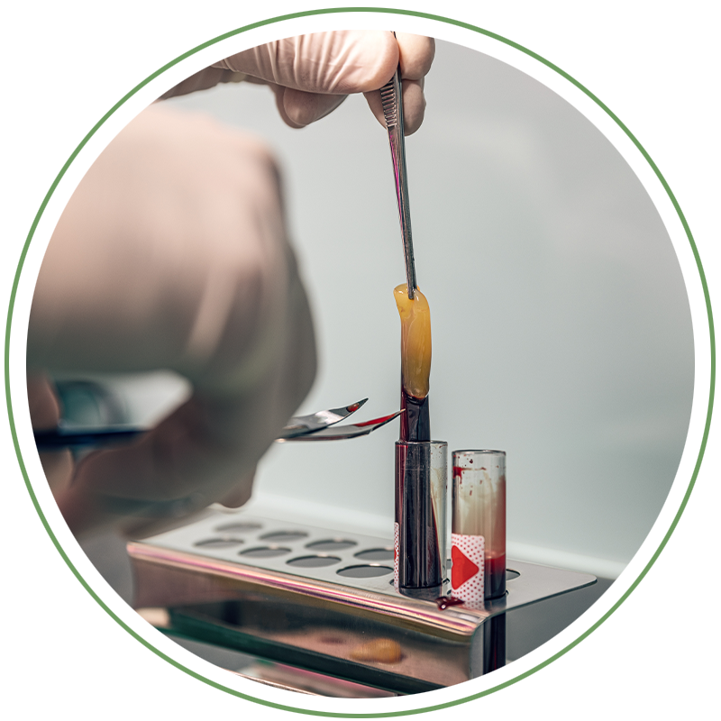 Platelet-Rich Fibrin