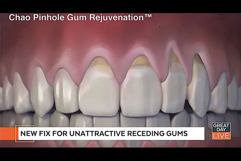 chao video corbin old