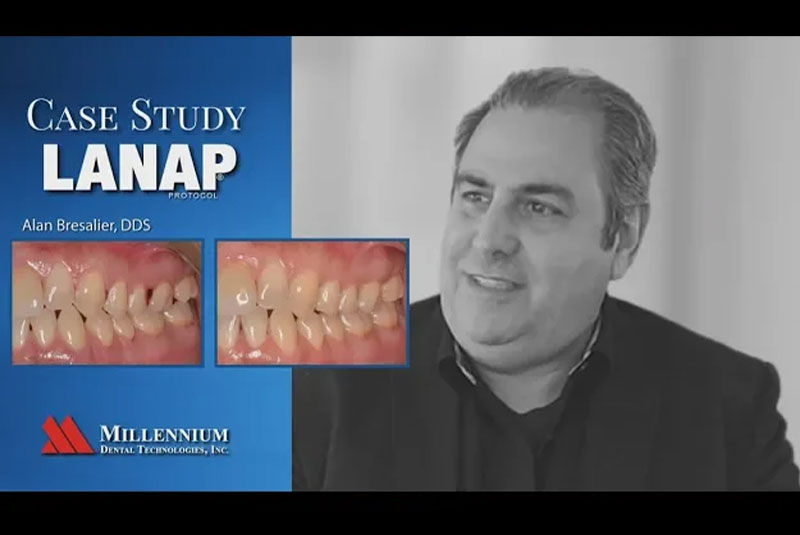 pt lanap pt 1 case study