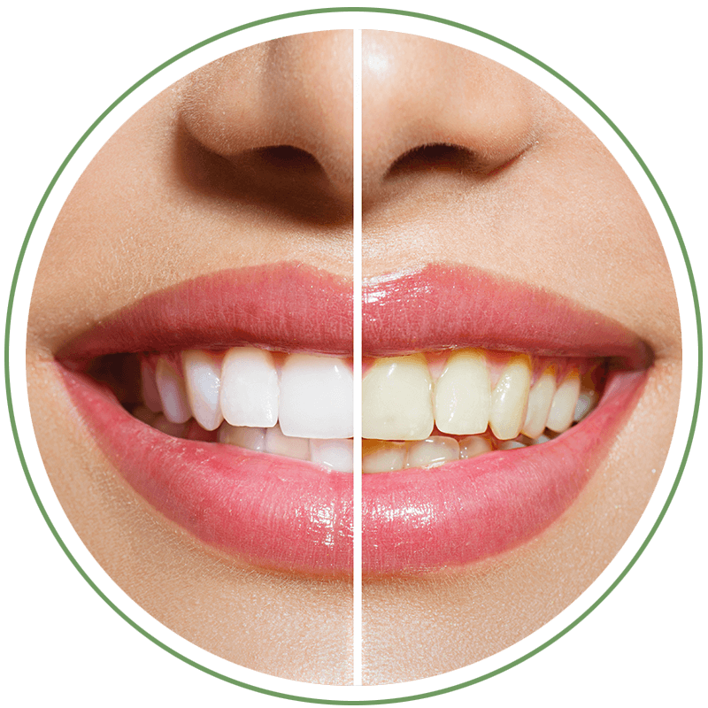 white before after cir